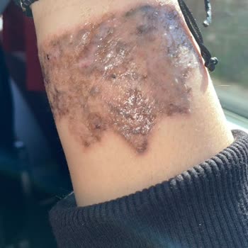 Suit Güzellik Merkezleri Alanya Mağduriyetimi Gidermiyorlar