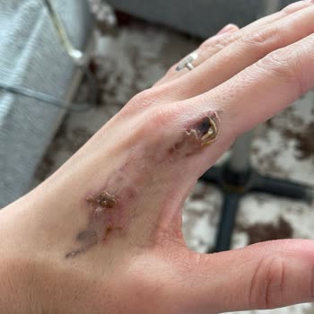 Suit Güzellik Merkezleri Alanya Mağduriyetimi Gidermiyorlar