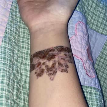 Suit Güzellik Merkezleri Alanya Mağduriyetimi Gidermiyorlar