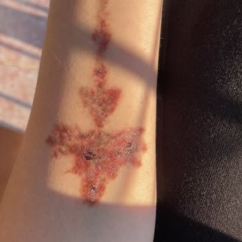 Suit Güzellik Merkezleri Alanya Mağduriyetimi Gidermiyorlar
