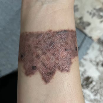 Suit Güzellik Merkezleri Alanya Mağduriyetimi Gidermiyorlar