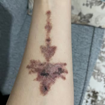 Suit Güzellik Merkezleri Alanya Mağduriyetimi Gidermiyorlar