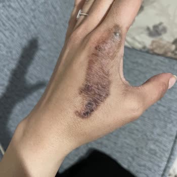 Suit Güzellik Merkezleri Alanya Mağduriyetimi Gidermiyorlar