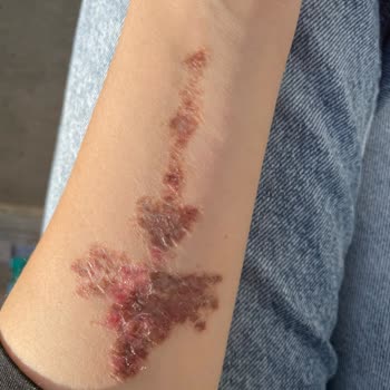 Suit Güzellik Merkezleri Alanya Mağduriyetimi Gidermiyorlar