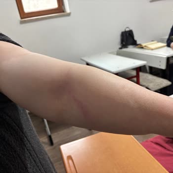 Hatalı Tomografi İşlemi Ve İlgisiz Hastane Personeli