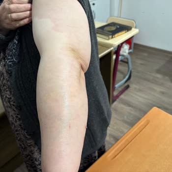 Hatalı Tomografi İşlemi Ve İlgisiz Hastane Personeli