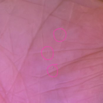 İphone 15 Kamera Sorunu Ve Yetersiz Teknik Destek