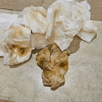 Siparişimdeki Ürünler Zarar Gördü