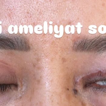 Yanlış Ameliyat Sonrası Mağduriyet