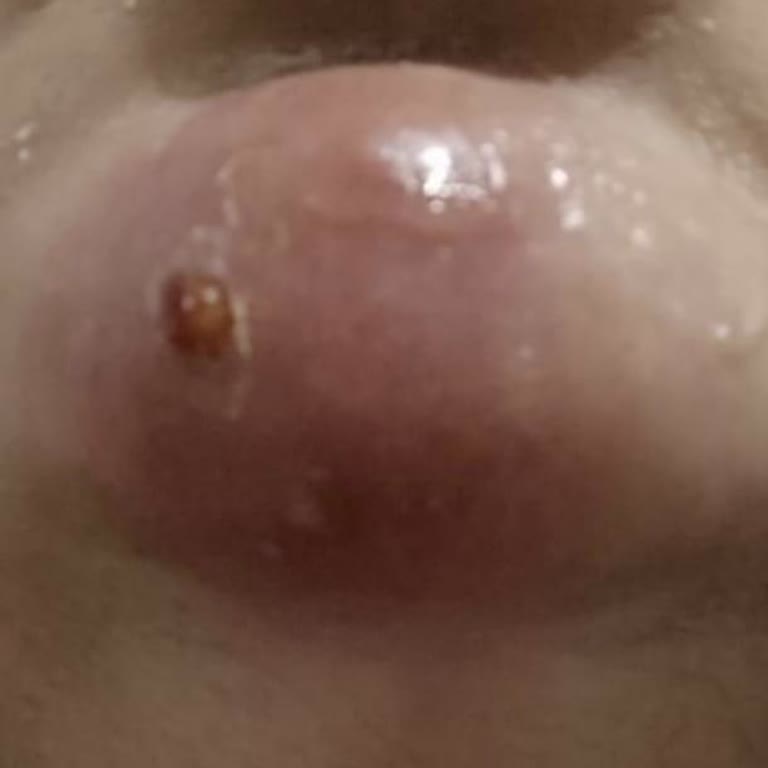 Estpoint Estetik Merkezinde Hayal Kırıklığı: Sağlık Ve Para Kaybı