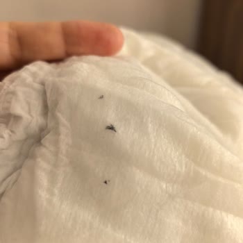 Bebek Bezi İçinden Çıkan Yabancı Madde Şoku