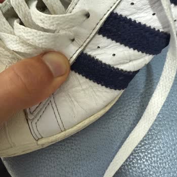 Adidas Ayakkabılarımın Kalitesizliği Ve Çözüm Eksikliği