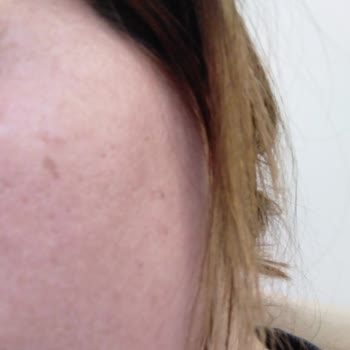 Cream Co. Cildimde Kızarıklığa Sebep Oldu