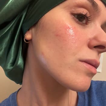 Yanlış Ürün Tavsiyesi Cildime Zarar Verdi