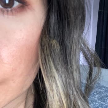 Yanık Kokusu Ve Kopmalar: Fantom Jolie Hayal Kırıklığı