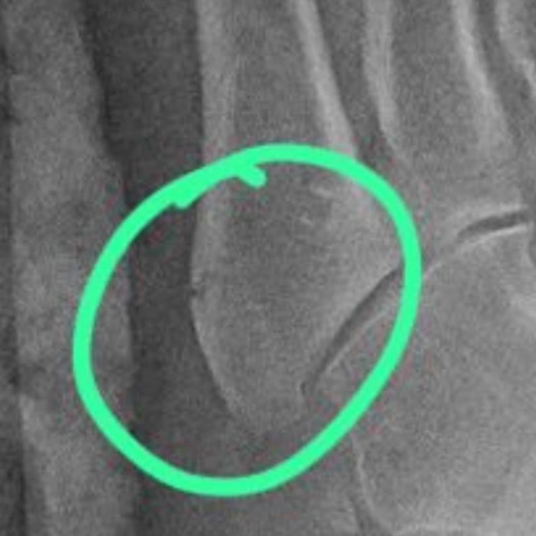 Yanlış Teşhis Ve Yetersiz Hizmet