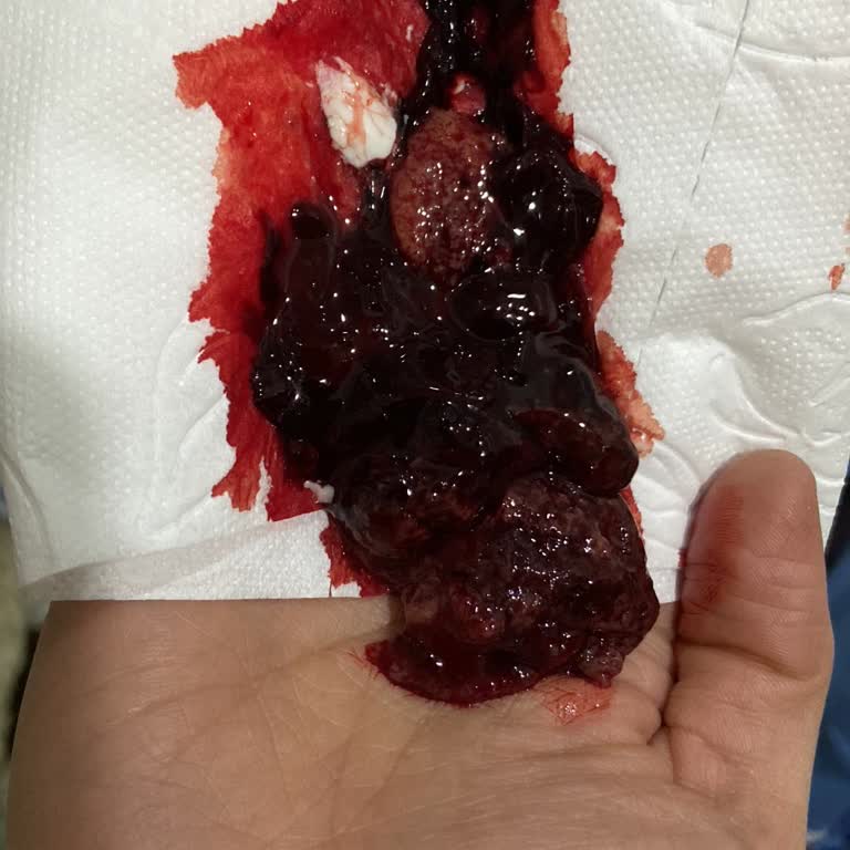 Yanlış Bilgilendirme Ve İhmalkarlık Sonucu Yaşanan Kayıp