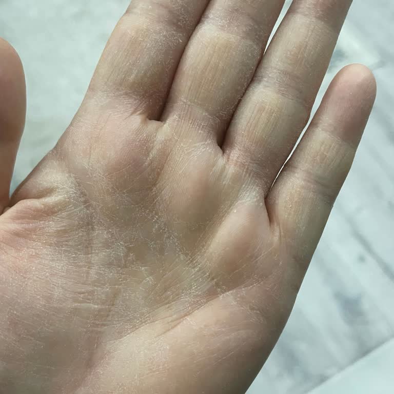 Glint Bitkisel Çözücü Fenomenlerin Övdüğü Marka Ellerimi Mahvetti!