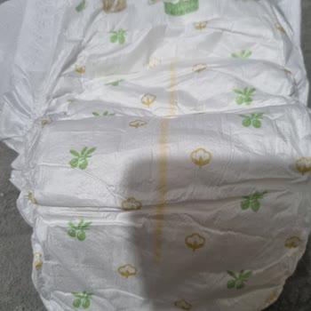 Bebek Bezinde Sağlık Tehdidi: Jelimsi Madde Şoku