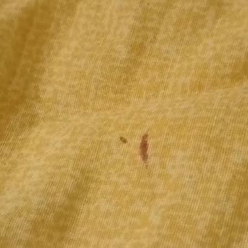 Vivense'den Alınan Baza Setinde Tahta Kurusu Sorunu