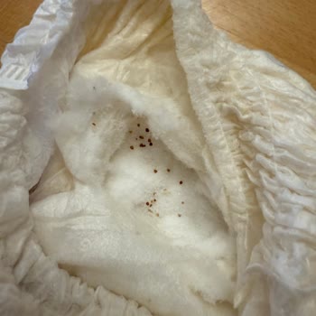 Sleepy Külot Bezlerinde Dökülme Sorunu