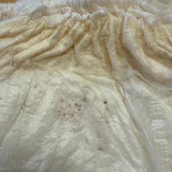 Sleepy Külot Bezlerinde Dökülme Sorunu