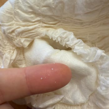 Sleepy Külot Bezlerinde Dökülme Sorunu