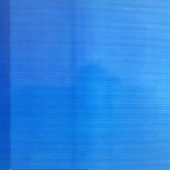 Philips TV Panel Sorunları Ve Garantili Ürün Süreç Sorunları!
