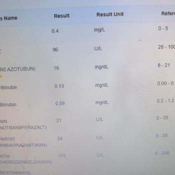 Defolu Üründe İade Sorunu: Kargo Ücreti Ve Para İadesi Mağduriyeti
