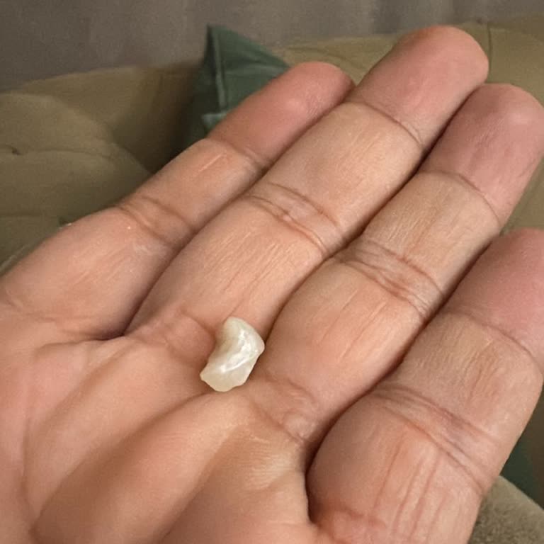 Vividenta Diş Klinik Diş Tedavisinde Hayal Kırıklığı