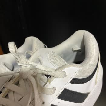 Adidas Ayakkabıda Topuk Sorunu