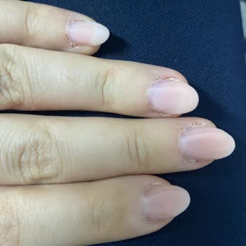 Aymira Koçaklı Yaşam Merkezi Bartın Şikayeti