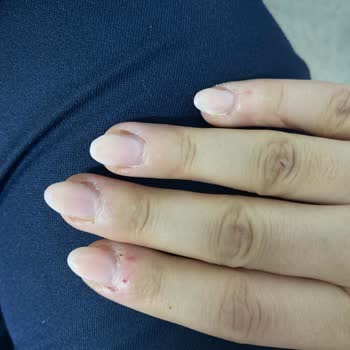 Aymira Koçaklı Yaşam Merkezi Bartın Şikayeti