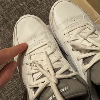 Skechers Ayakkabılarında Kalite Sorunu Ve İade Problemi