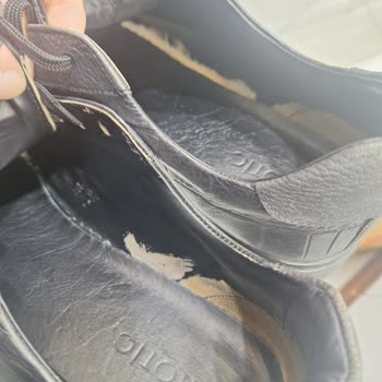 Ayakkabı Deformasyonu Ve Mağaza İlgisizliği