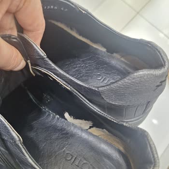 Ayakkabı Deformasyonu Ve Mağaza İlgisizliği