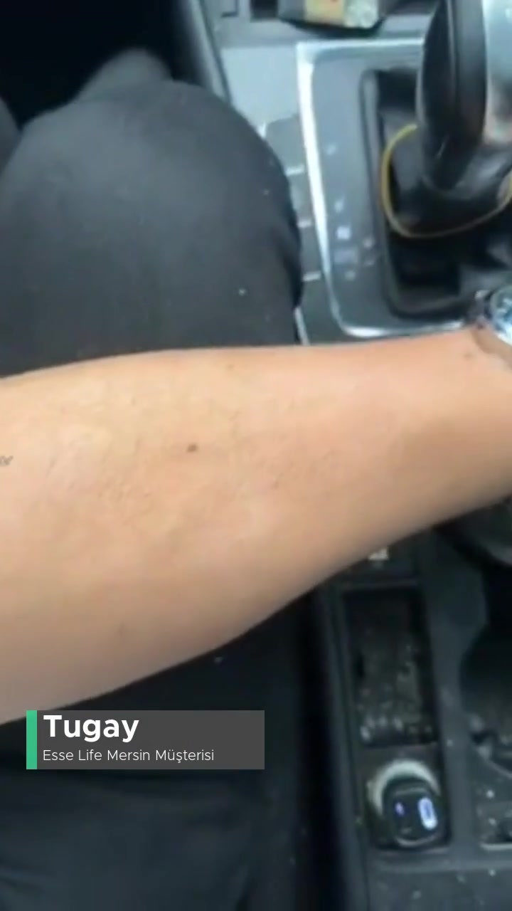 Mersin Esse Life Pozcu Şubesi Kolumu Yaktı Ve İlgilenmediler! videonun kapak resmi
