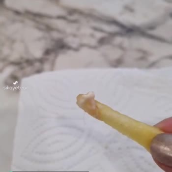 Burger King Patateste Kıl Çıktı