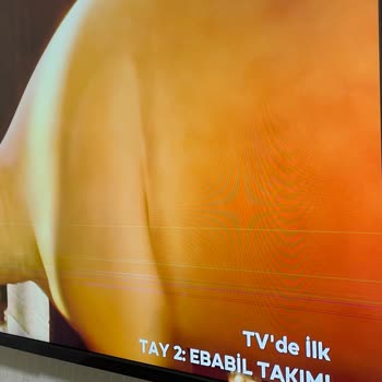 Onvo Televizyon: Hayal Kırıklığı Ve Destek Eksikliği