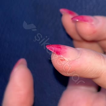 Mantar Şoku: Hijyen Ve İşçilikte Büyük Hayal Kırıklığı