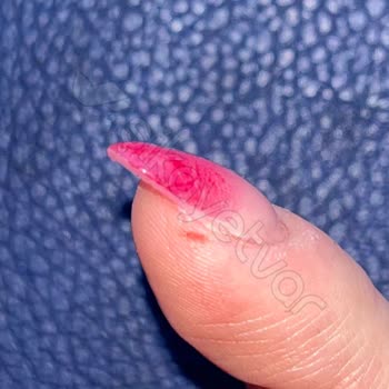 Mantar Şoku: Hijyen Ve İşçilikte Büyük Hayal Kırıklığı