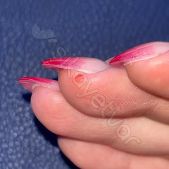 Mantar Şoku: Hijyen Ve İşçilikte Büyük Hayal Kırıklığı