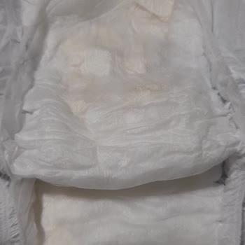 Sleepy Bebek Bezlerinde Sızıntı Ve Sertlik Sorunu