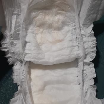 Sleepy Bebek Bezlerinde Sızıntı Ve Sertlik Sorunu