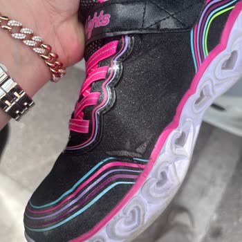 Skechers Çocuk Ayakkabısında Erken Açılma Sorunu