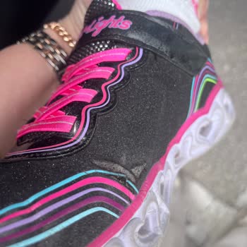 Skechers Çocuk Ayakkabısında Erken Açılma Sorunu
