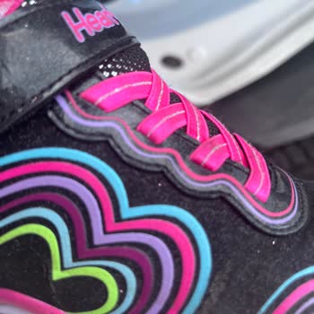 Skechers Çocuk Ayakkabısında Erken Açılma Sorunu