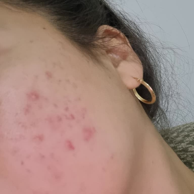 Dr. Hatice Coşkun Güngördü Tedaviden Sonuç Alamadım