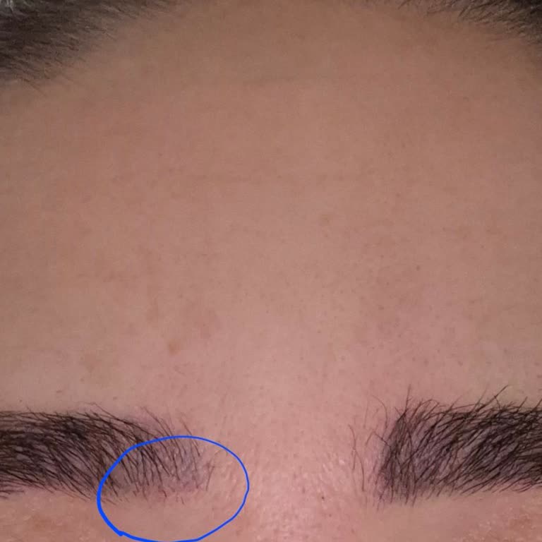 Microblading İşleminde Hayal Kırıklığı Ve Yüksek Fiyat
