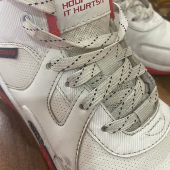 Skechers Ayakkabıda 5 Ayda Deri Yırtılması Ve İlgisizlik